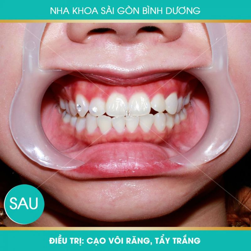 Nha khoa Sài Gòn Bình Dương Nha khoa Sài Gòn Bình Dương