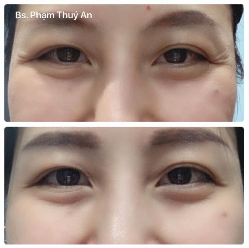 Phòng khám Da Liễu Bác sĩ Phạm Thúy An Phòng khám Da Liễu Bác sĩ Phạm Thúy An