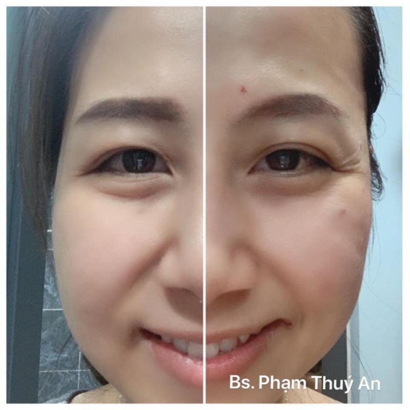 Phòng khám Da Liễu Bác sĩ Phạm Thúy An Phòng khám Da Liễu Bác sĩ Phạm Thúy An