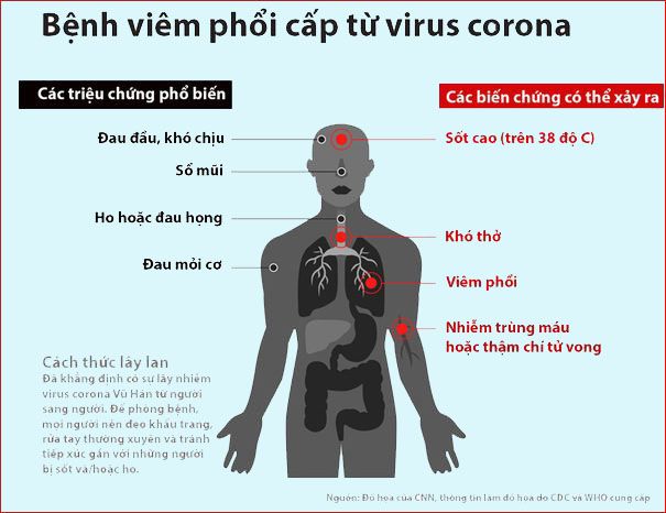 Triệu chứng của virus corona