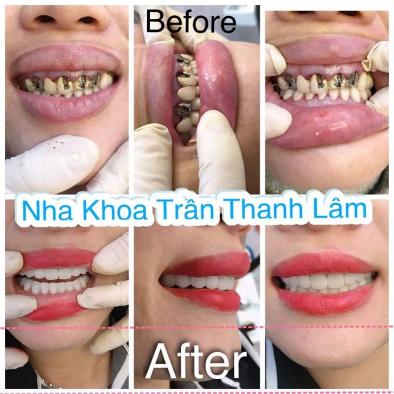 Nha Khoa Trần Thanh Lâm