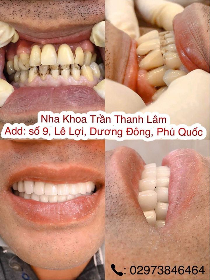 Nha Khoa Trần Thanh Lâm