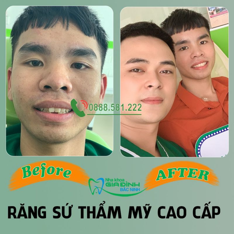 Nha khoa Gia Đình Bắc Ninh Nha khoa Gia Đình Bắc Ninh
