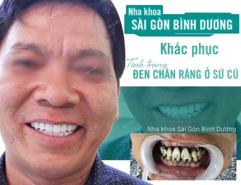 Nha khoa Sài Gòn Bình Dương Nha khoa Sài Gòn Bình Dương