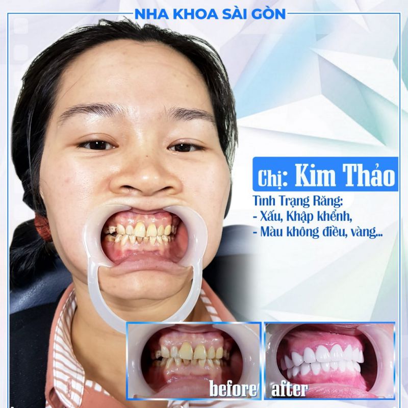 Nha khoa Sài Gòn Bình Dương Nha khoa Sài Gòn Bình Dương