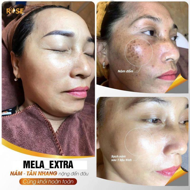 Thẩm Mỹ Viện Rose Thẩm Mỹ Viện Rose