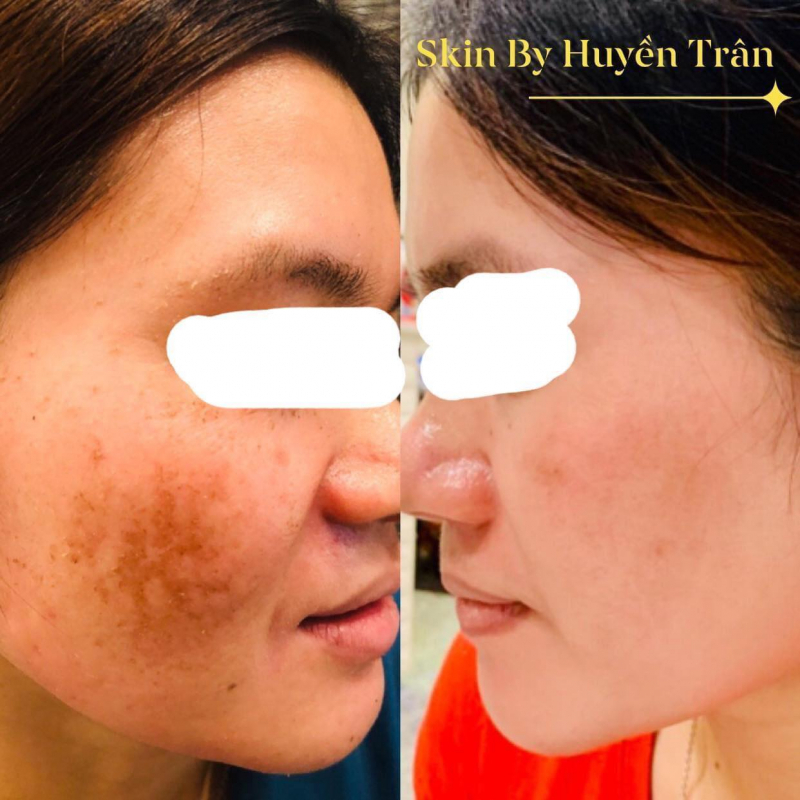Skin by Huyen Tran Spa