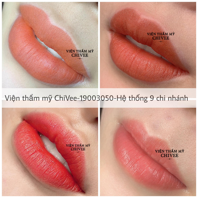 Viện Thẩm Mỹ ChiVee