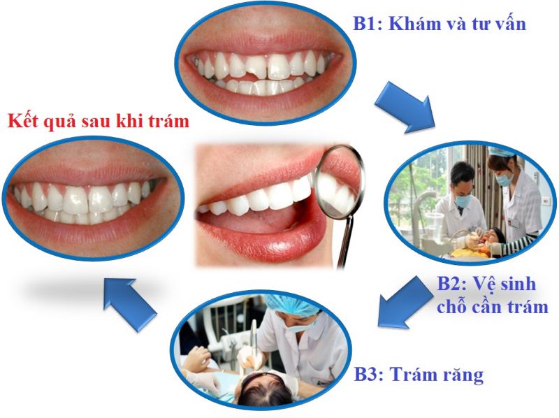 NHA KHOA PARIS