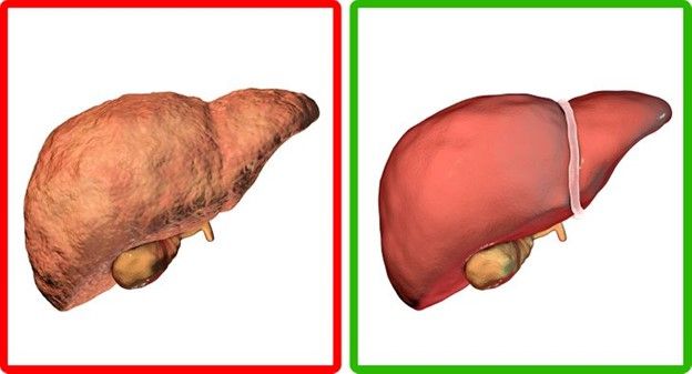 Sữa nghệ giúp giải độc gan