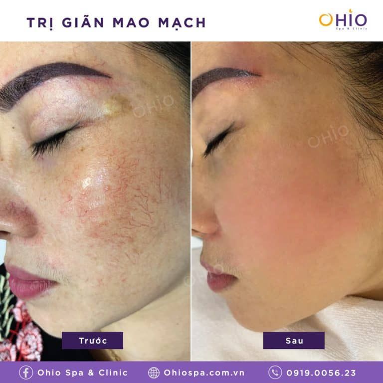 Thẩm mỹ OHIO