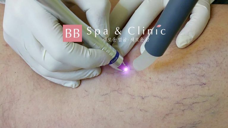 Thẩm mỹ Quốc tế BB