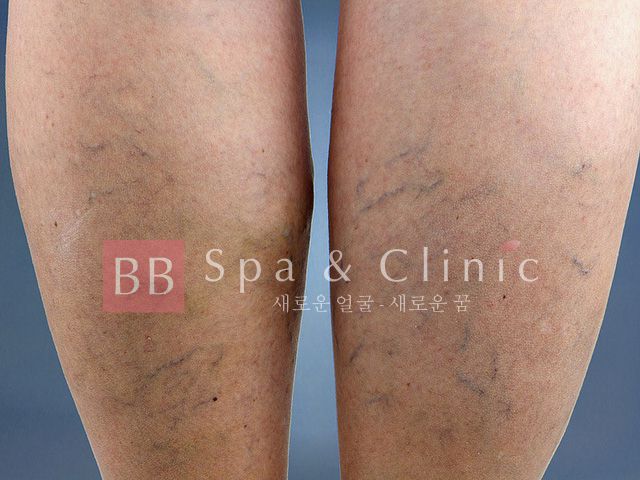 Thẩm mỹ Quốc tế BB