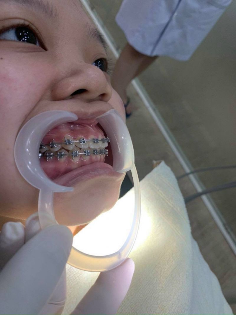 Nha Khoa Sài Gòn Bến Thành