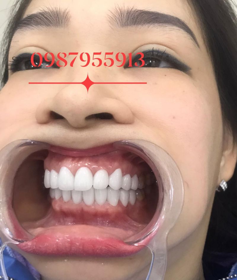 Nha Khoa Tâm Đức Phan Rang