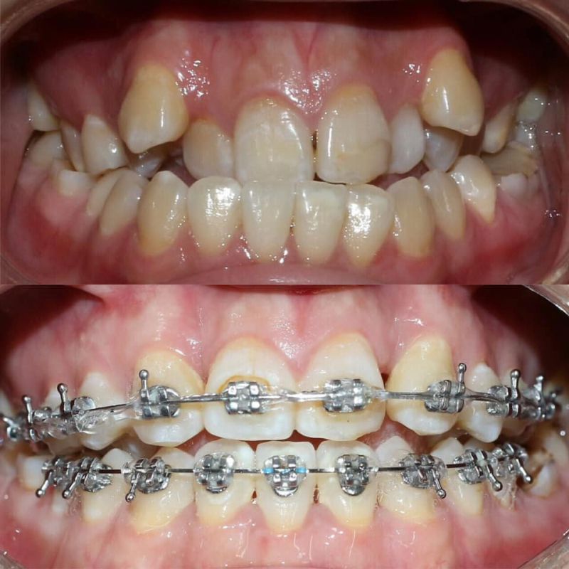 Nha Khoa Tâm Phước