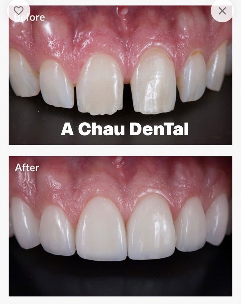 Nha Khoa Thẩm Mỹ Á Châu