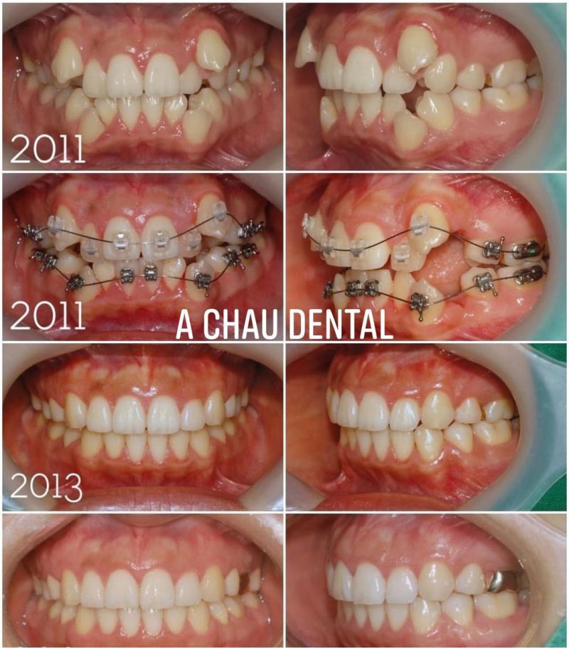 Nha Khoa Thẩm Mỹ Á Châu