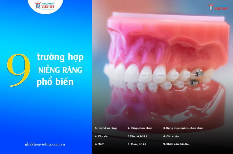 Nha Khoa Việt Mỹ