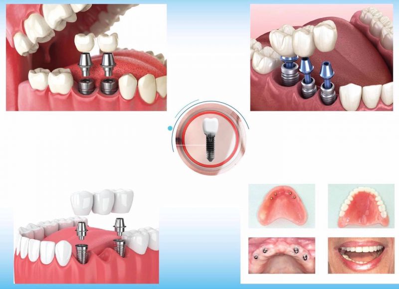 Nha Khoa Việt Mỹ Lâm Đồng