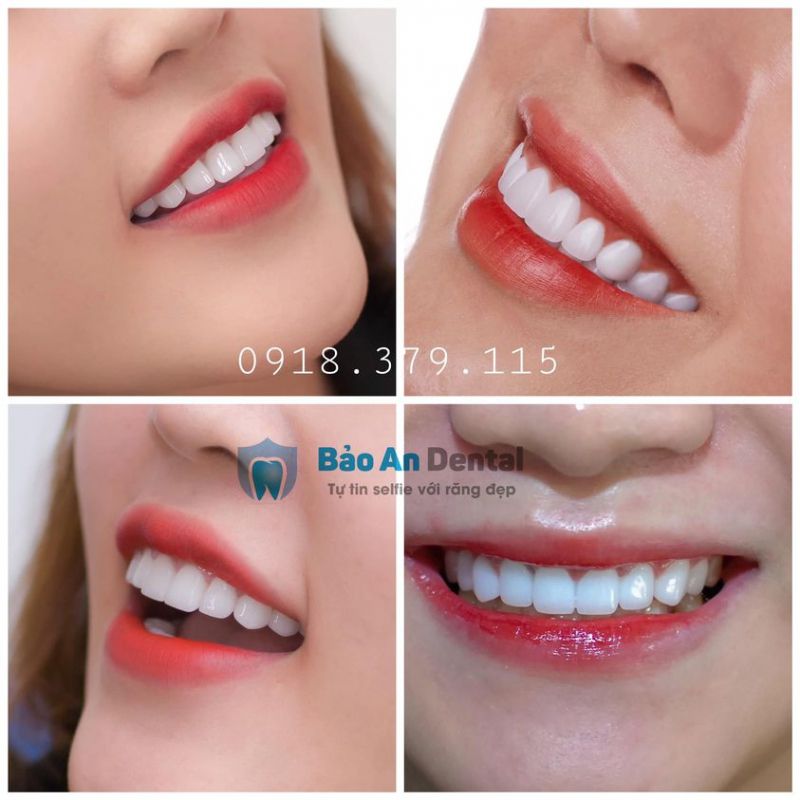 Nha khoa Bao An Dental