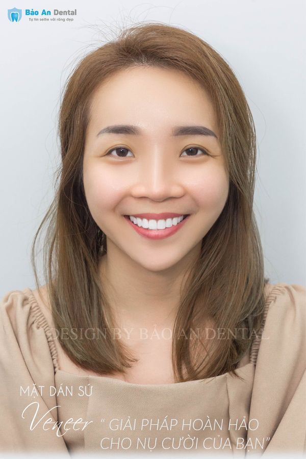 Nha khoa Bao An Dental