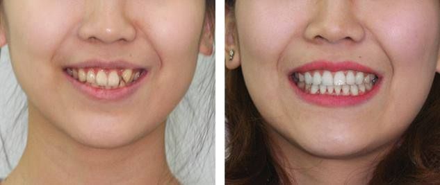 Nha khoa Minh Đức