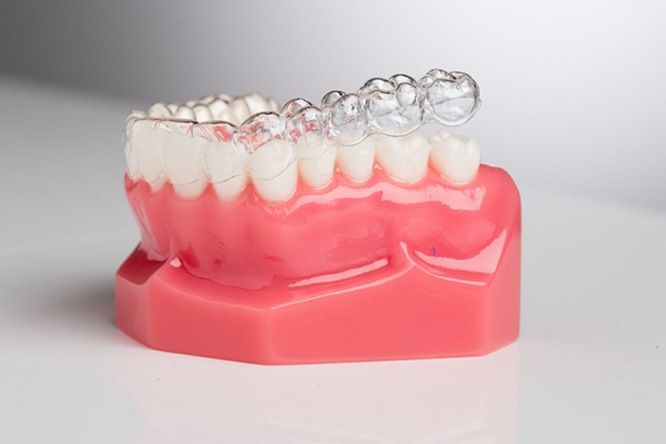 Lưu ý khi sử dụng khay niềng invisalign