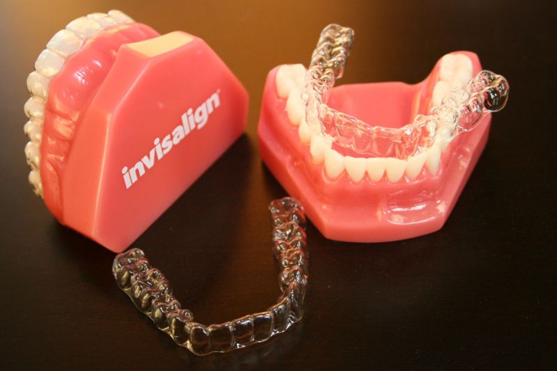 Lưu ý khi sử dụng khay niềng invisalign