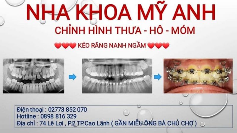 Nha Khoa Mỹ Anh Nha Khoa Mỹ Anh