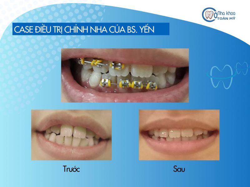 Nha Khoa Toàn Mỹ Nha Khoa Toàn Mỹ