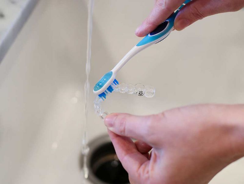 Vệ sinh răng miệng sau khi niềng răng trong suốt invisalign