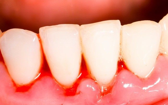 Đừng bỏ qua những dấu hiệu bất thường Đừng bỏ qua những dấu hiệu bất thường