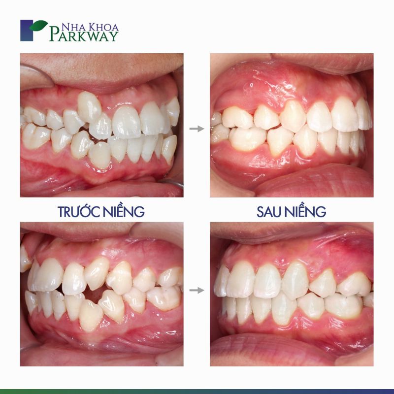 Nha Khoa Parkway