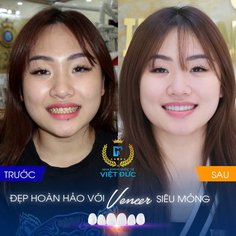 Nha Khoa quốc tế Việt Đức