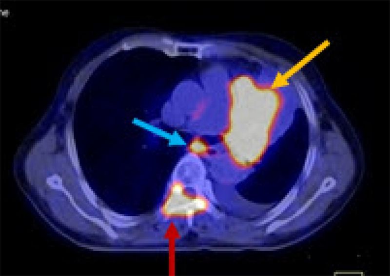 Top 7 Lưu ý quan trọng nhất về chụp PET/CT - Top Chuẩn