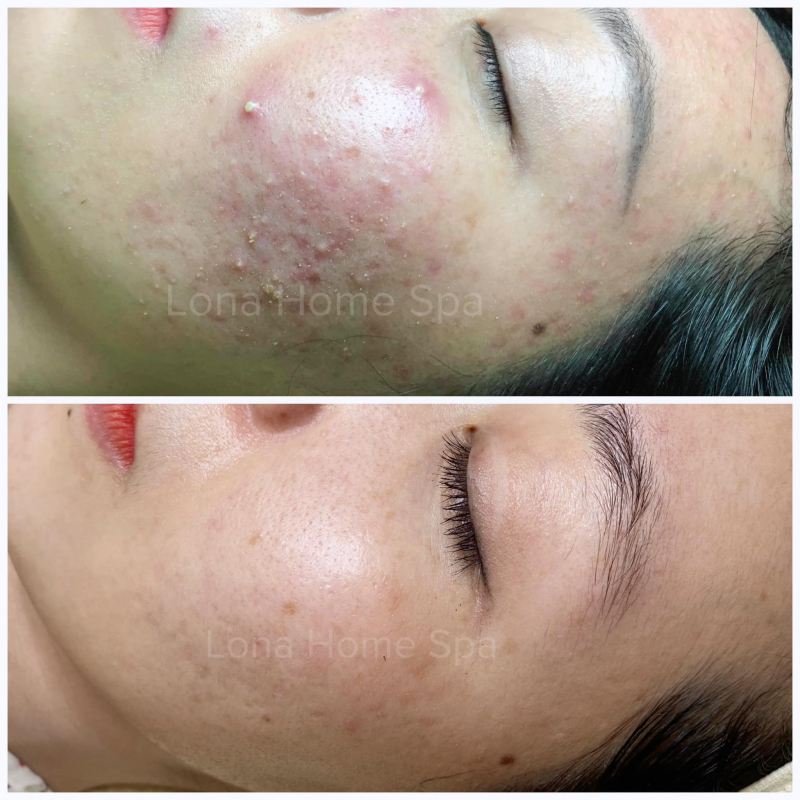 Lona Home Spa Cần Thơ Lona Home Spa Cần Thơ