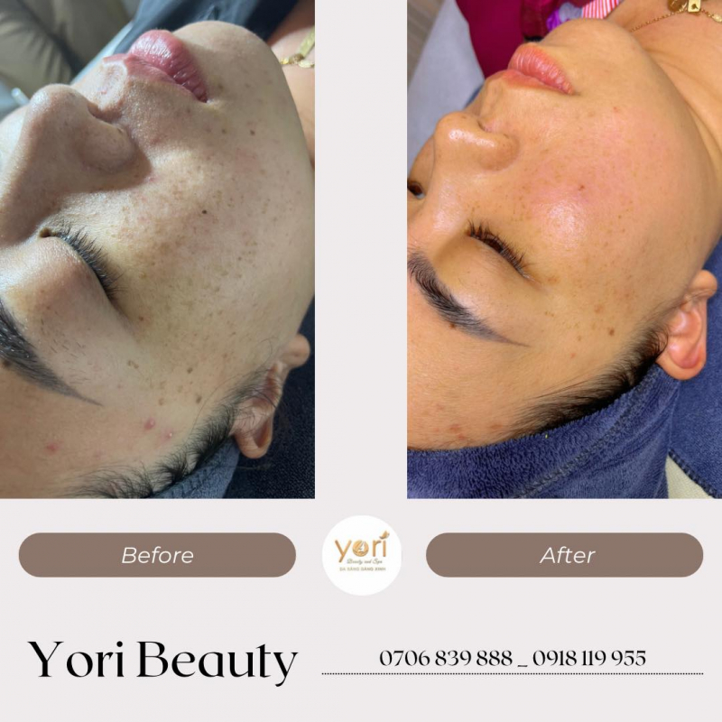 Yori Beauty & Spa Yori Beauty & Spa