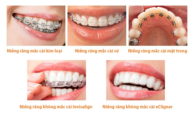 Nha khoa Niềm tin Nha khoa Niềm tin