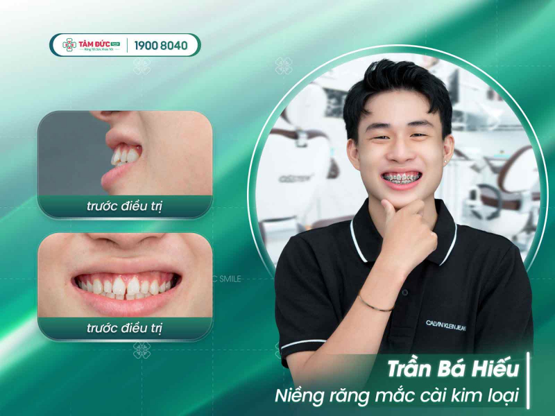 Nha khoa Tâm Đức Smile Nha khoa Tâm Đức Smile