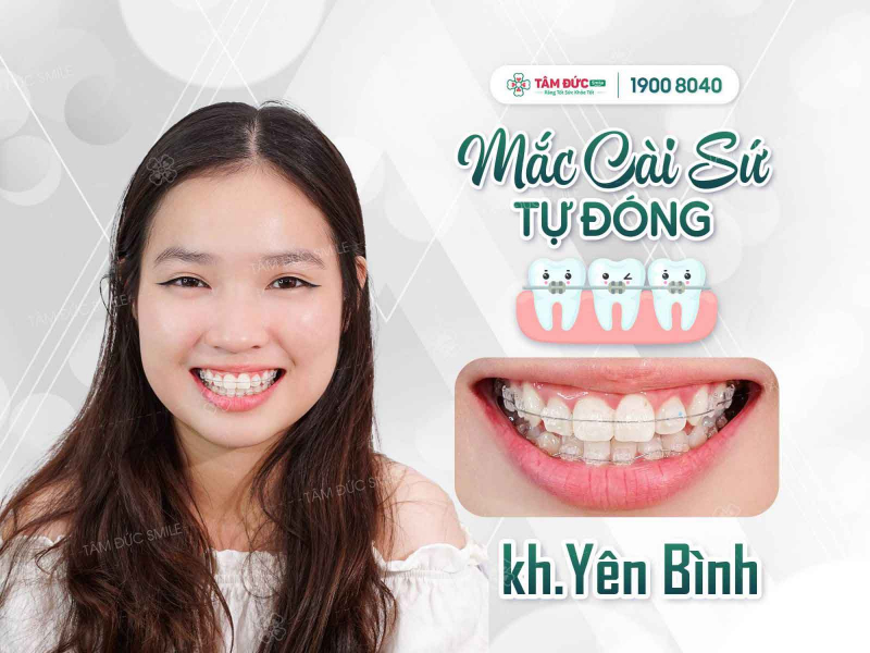Nha khoa Tâm Đức Smile Nha khoa Tâm Đức Smile