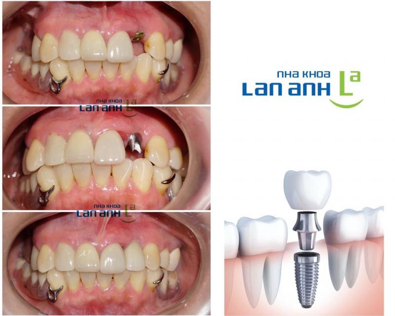 Nha khoa Lan Anh Nha khoa Lan Anh