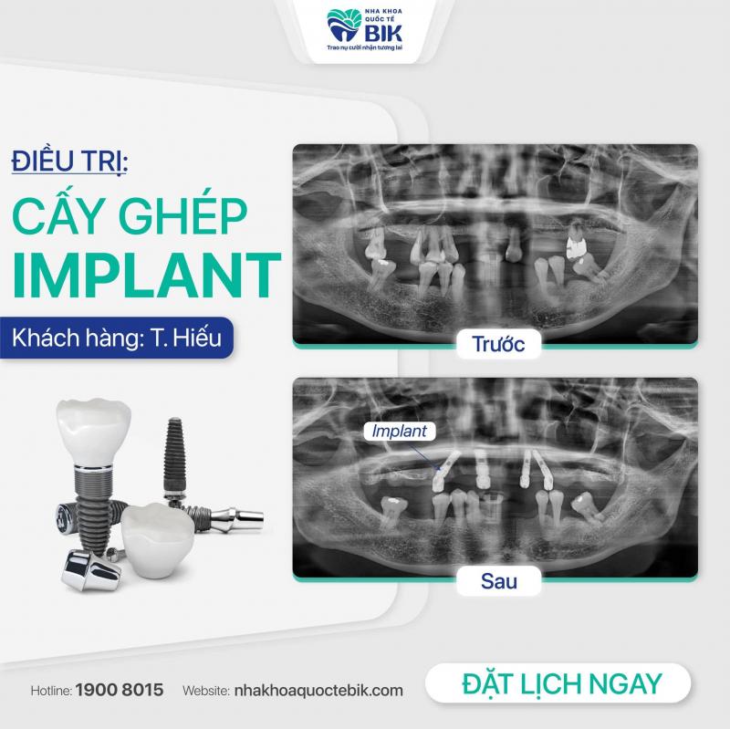 Nha khoa Quốc Tế BIK Nha khoa Quốc Tế BIK