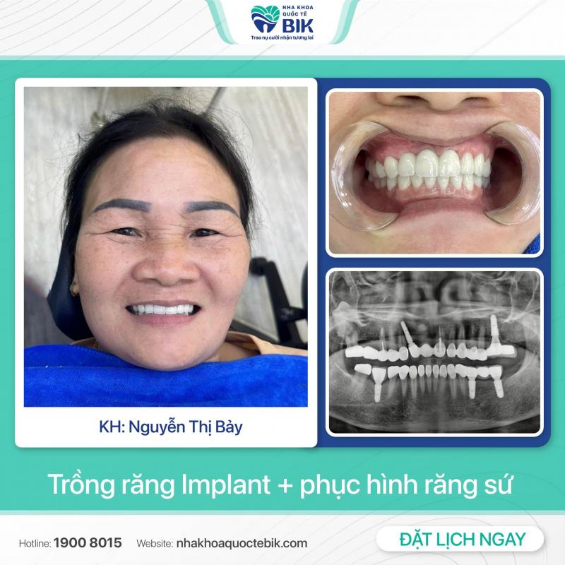 Nha khoa Quốc Tế BIK Nha khoa Quốc Tế BIK