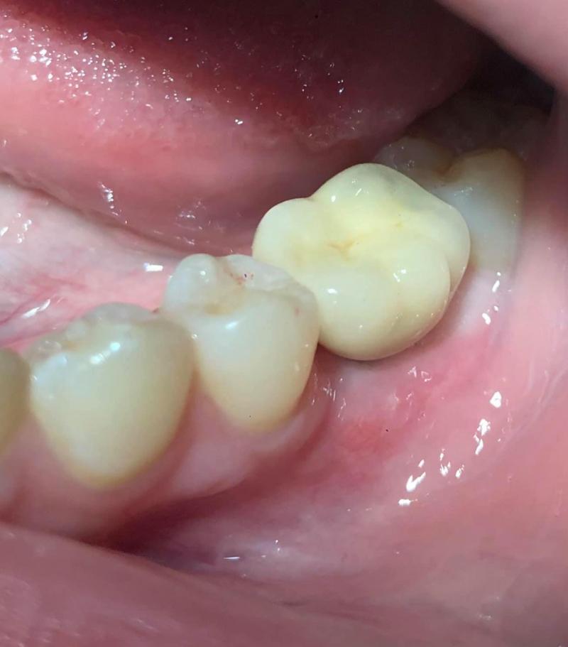 Nha Khoa Hải Nguyên