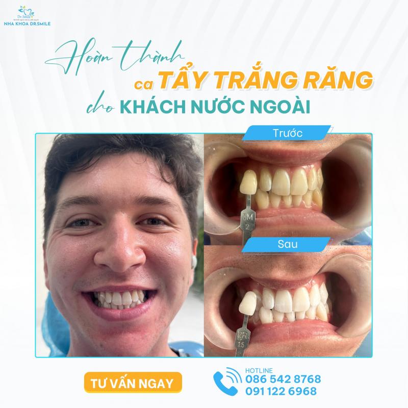 Nha khoa DrSmile Nha khoa DrSmile