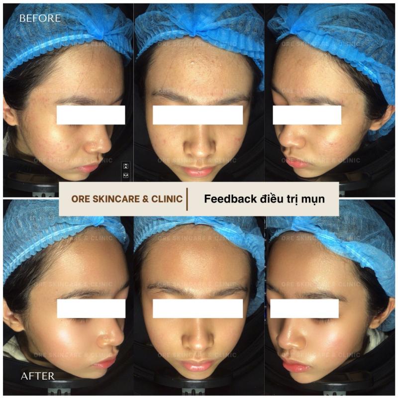 ORE Skincare & Clinic