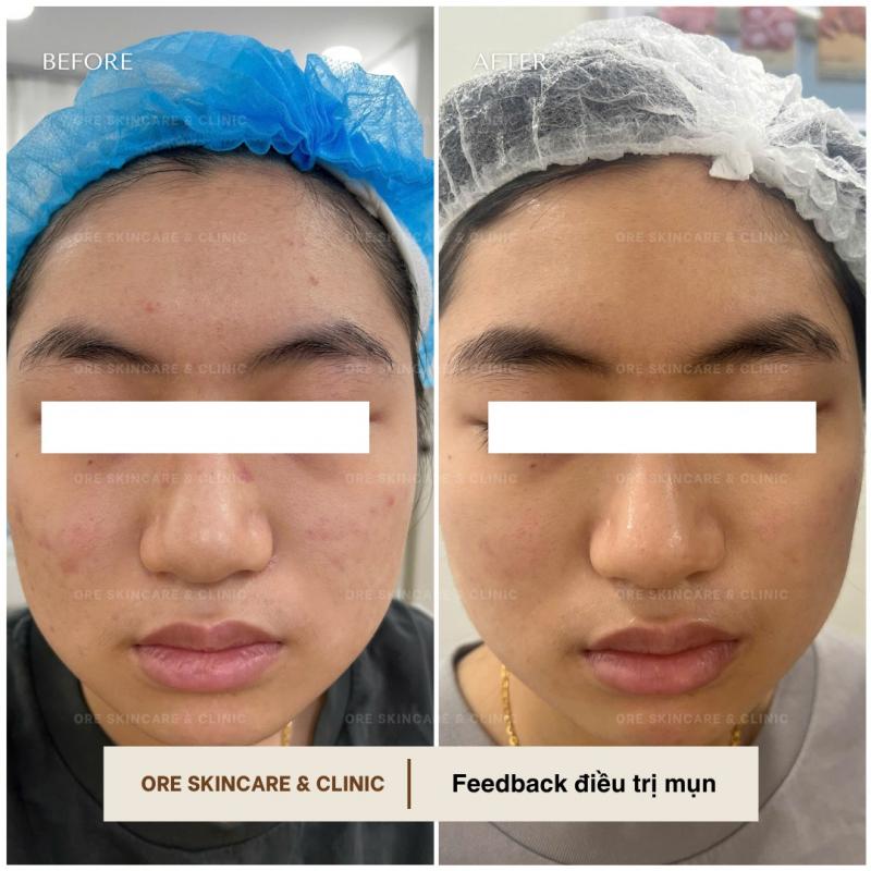 ORE Skincare & Clinic