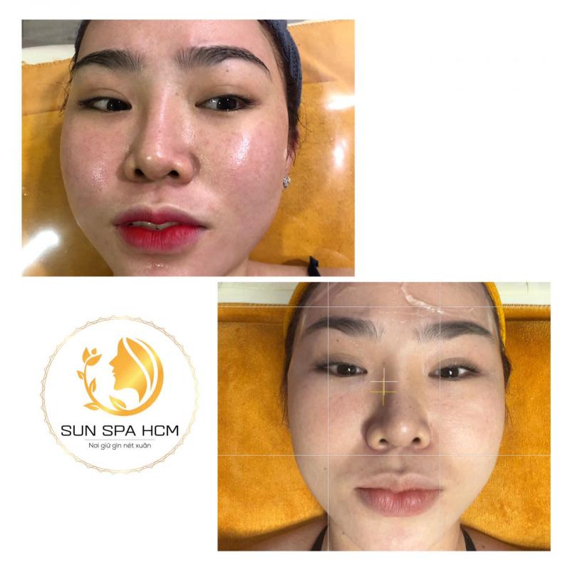 Sun Spa HCM