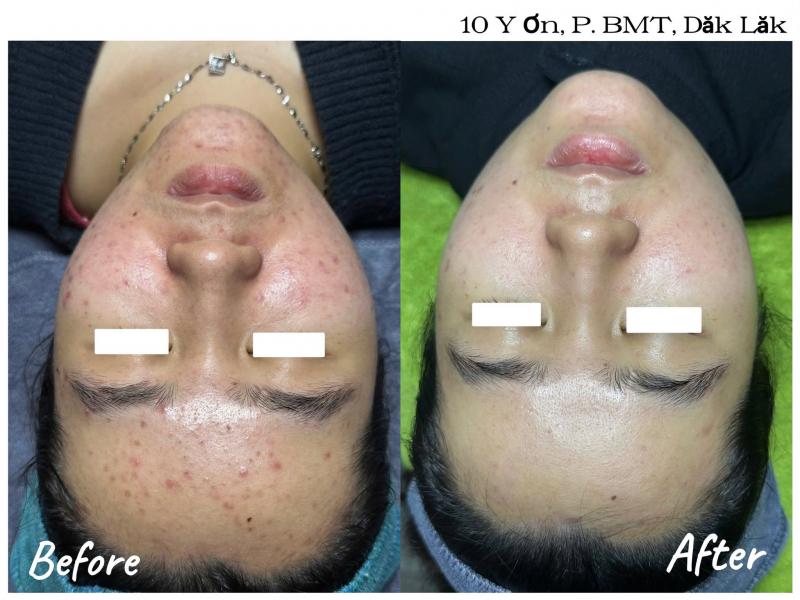 Phòng khám da liễu NU